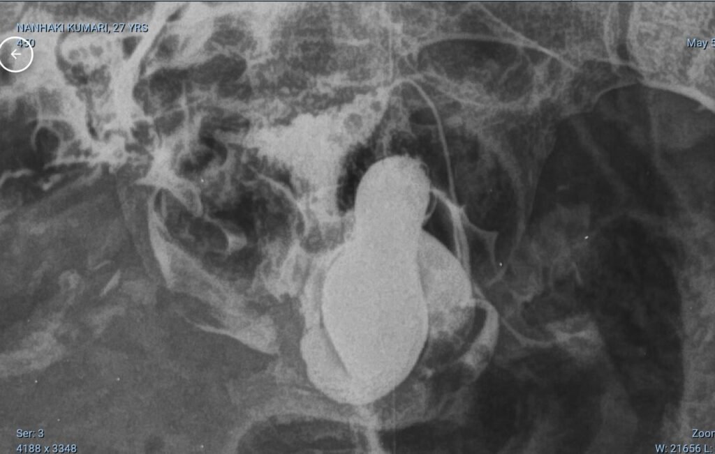 Hysterosalpingography whatsapp image 2026 05 05 at 10.12.53 pm (1)
